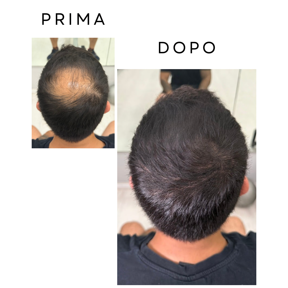 Belhair Hairline Powder©️| Ricrescita e diradamento, risolti in un attimo!