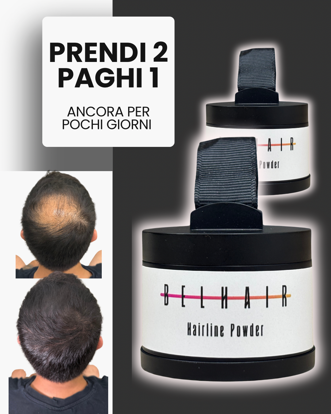 Belhair Hairline Powder©️| Ricrescita e diradamento, risolti in un attimo!